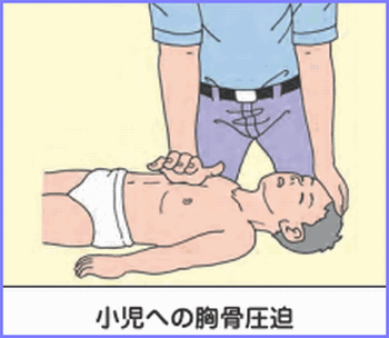 小児胸部圧迫