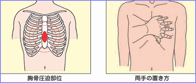 胸部圧迫部位