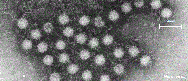 ノロウィルス
